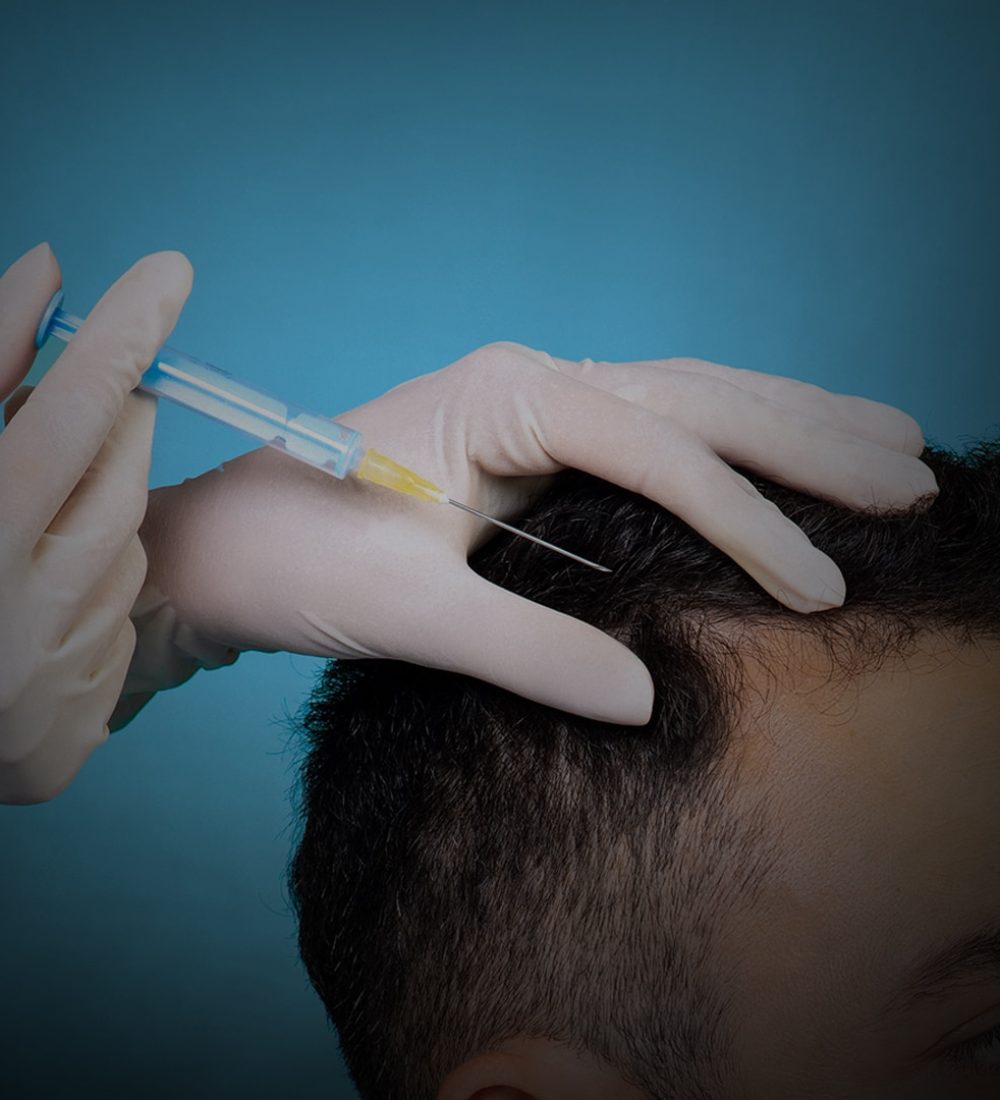 FUE-Hair-Transplant